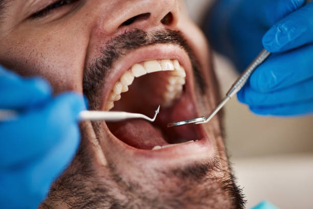 Best 24-Hour Emergency Dentist in Frankfort, KY